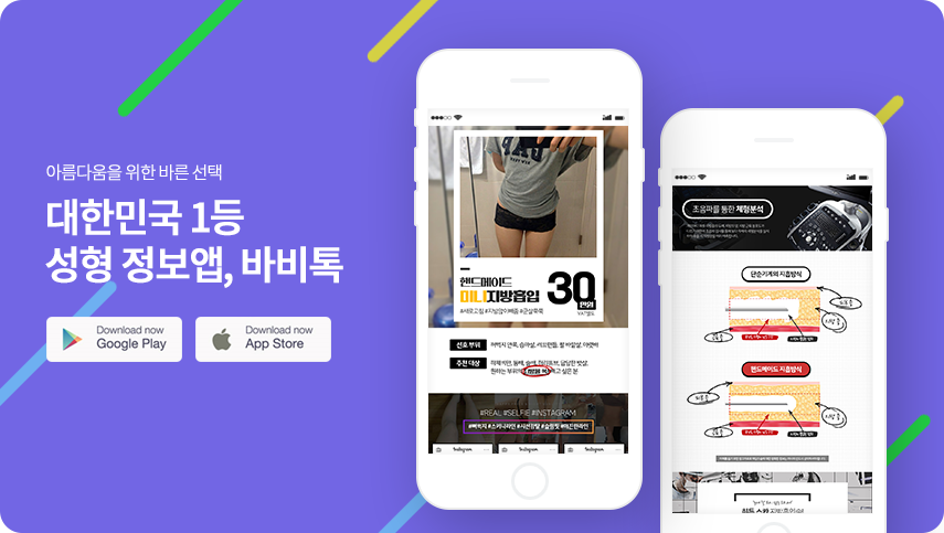 바비톡 지방흡입 상세페이지 디자인