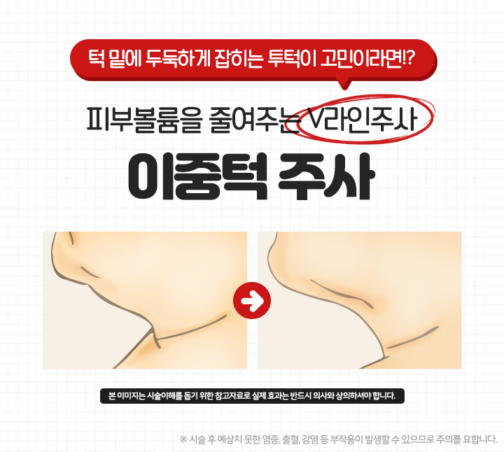썸네일 이미지 17