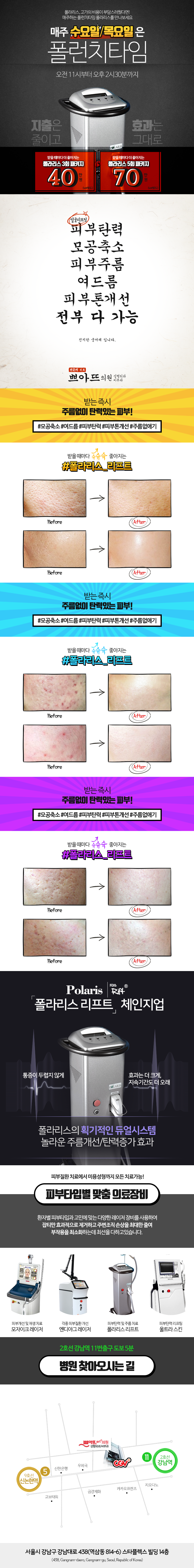 팝업 이미지 25